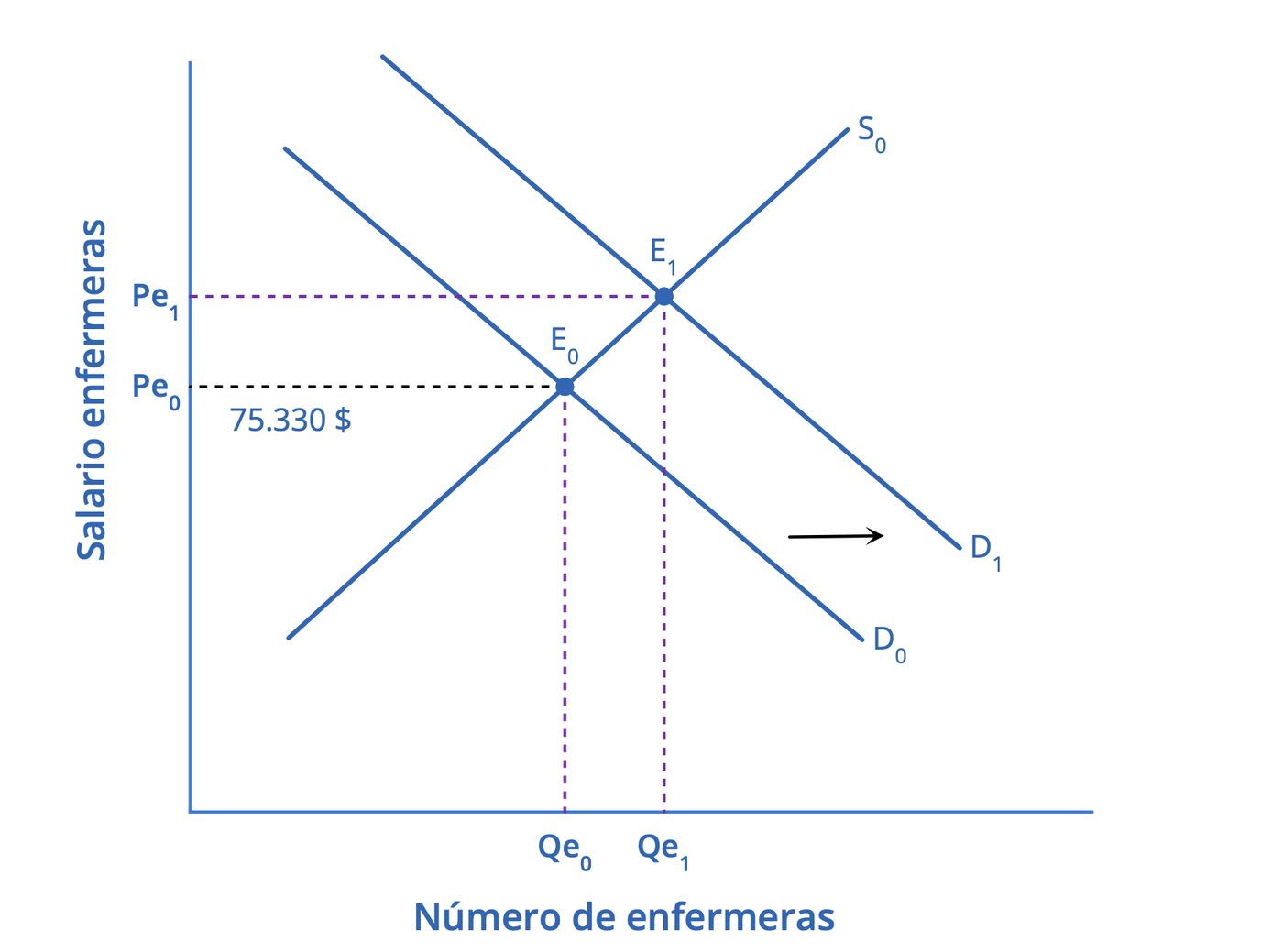 Impacto del aumento de la demanda de enfermeras entre 2020 y 2030